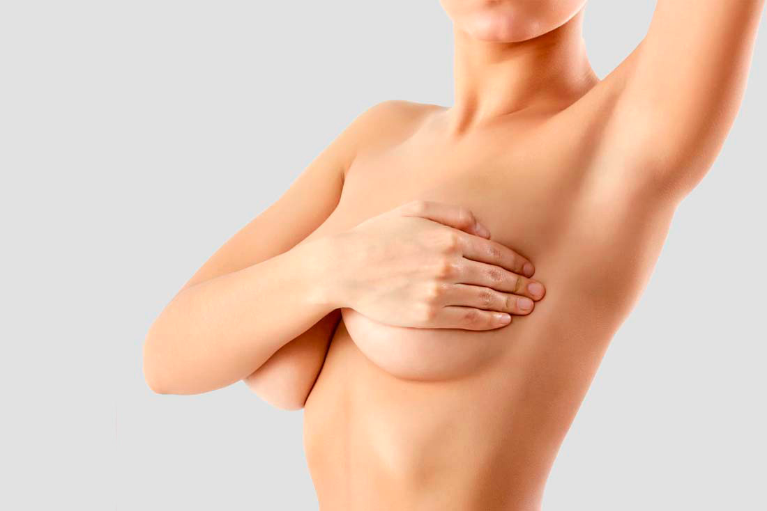 Mastopèxia elevació mamària Cirurgia mamària Girona