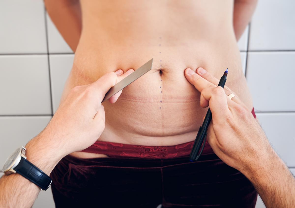 La cirugía del abdomen - Doctor Josep Maria Ribas Puntí